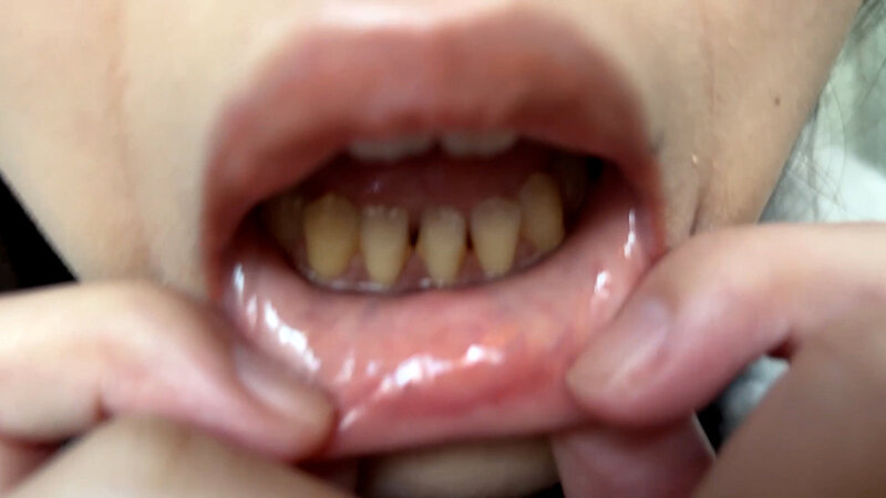 「【素人ナンパ】コールセンター勤務の美人お姉さんに街角で声かけ！口内観察に恥じらう姿が可愛すぎる」のサンプル画像5枚目