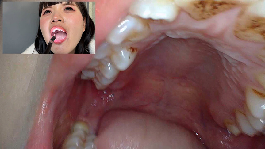 「【あむちゃん】素人コールセンター美女の口内観察プレイ【フェチ動画】街角ナンパ企画」のサンプル画像3枚目