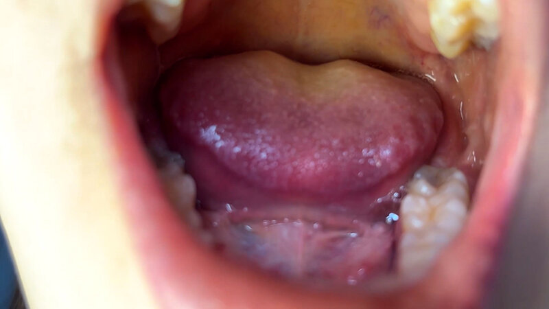 「【素人ナンパ】商社営業のお姉さんれなちゃんに街角で声かけ口内観察に挑戦」のサンプル画像7枚目