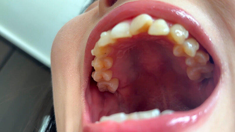 「【素人ナンパ】街角で声をかけたお姉さん店員みおりさんの恥じらい口内観察プレイ動画」のサンプル画像5枚目