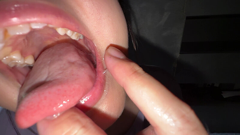 「【谷田かりな】素人お姉さんをナンパ!開口器で口内観察デカ舌チェック【個人撮影】」のサンプル画像17枚目