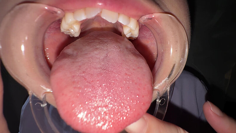 「【谷田かりな】素人お姉さんをナンパ!開口器で口内観察デカ舌チェック【個人撮影】」のサンプル画像20枚目