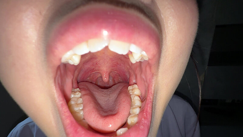 「【谷田かりな】素人お姉さんをナンパ!開口器で口内観察デカ舌チェック【個人撮影】」のサンプル画像4枚目