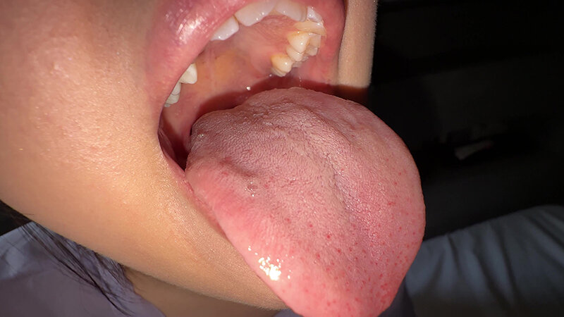 「【谷田かりな】素人お姉さんをナンパ!開口器で口内観察デカ舌チェック【個人撮影】」のサンプル画像8枚目