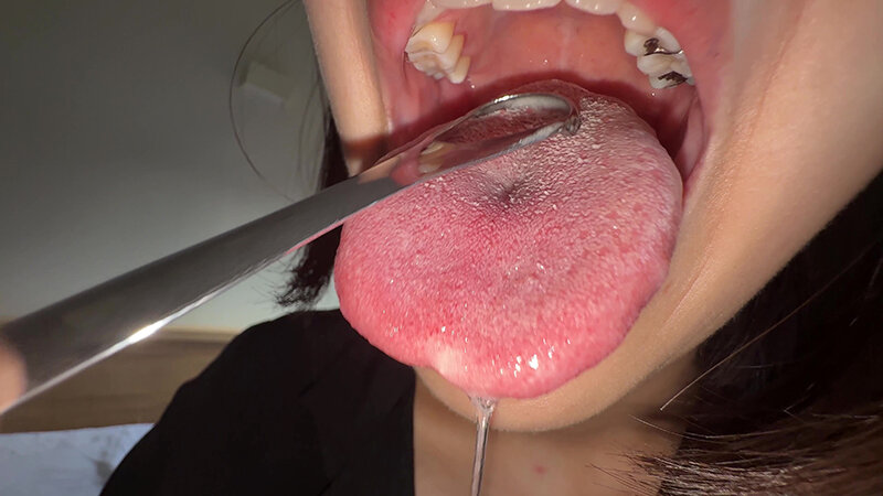 「【湊波流】素人お姉さんをナンパ！舌ブラシで汚舌苔採取する個人撮影動画」のサンプル画像12枚目