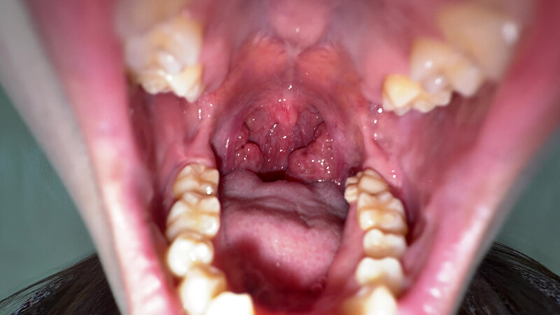 「【水月みお】素人お姉さんをナンパ！初めての喉奥体験と舌・八重歯観察の個人撮影動画」のサンプル画像7枚目