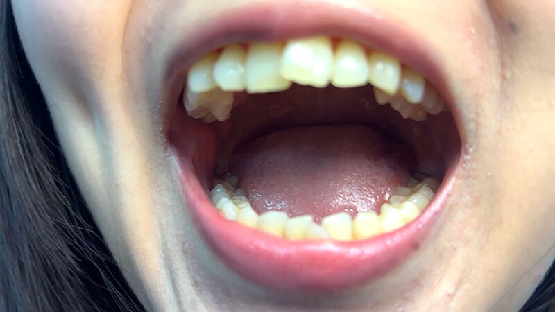 「【素人ナンパ】街角お姉さんみゆりちゃんの口内観察！テレビ局AD美女が恥じらい体験」のサンプル画像2枚目