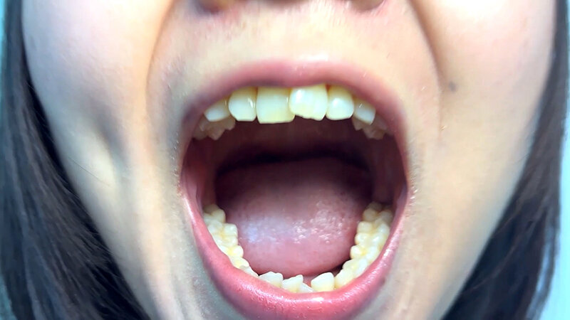 「【素人ナンパ】街角お姉さんみゆりちゃんの口内観察！テレビ局AD美女が恥じらい体験」のサンプル画像3枚目