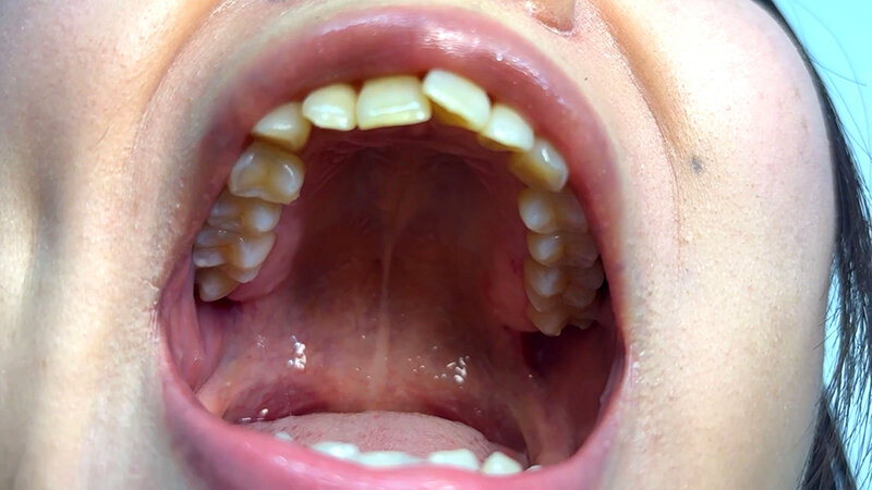 「【素人ナンパ】街角お姉さんみゆりちゃんの口内観察！テレビ局AD美女が恥じらい体験」のサンプル画像4枚目